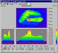 T-scan 信号距離情報解析